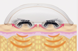 独自の“3Dシェイク”運動を行うオートローラーを搭載。