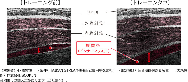 〈対象者〉47歳男性〈条件〉Taikan Stream使用前と使用中を比較〈測定機器〉超音波画像診断装置〈実施機関〉株式会社 Souken 効果には個人差があります(当社調べ)。